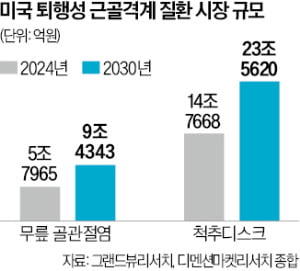 [뉴스] 코오롱티슈진 인보사의 도전…무릎 넘어 척추 치료제로 개발