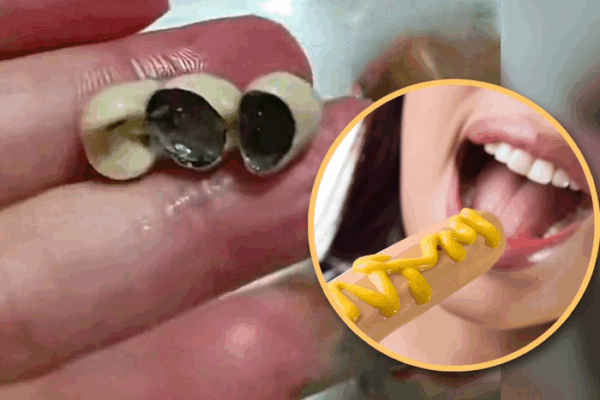 [뉴스] “소세지·딤섬에서 ‘사람 치아’가?”…중국 식품 속 이물질 발견 잇따라