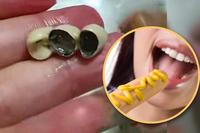 [뉴스] “소세지·딤섬에서 ‘사람 치아’가?”…중국 식품 속 이물질 발견 잇따라