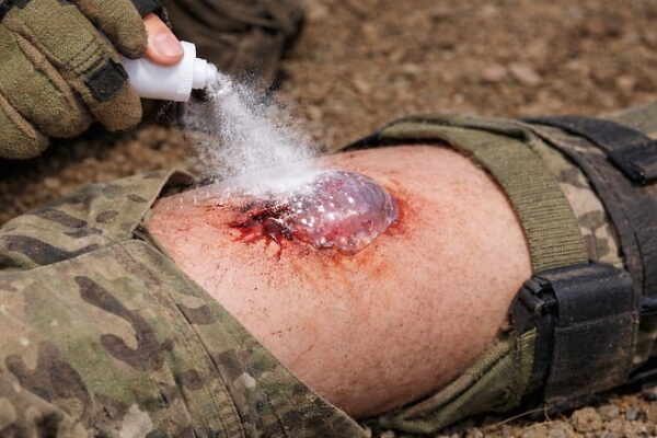 [뉴스] 뿌리면 1초 만에 지혈…KAIST가 개발한 전장형 의료 기술의 정체