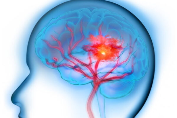 [뉴스] 뇌질환 치료제 시장 꿈틀…BBB 투과 기술이전 성과 2배 껑충