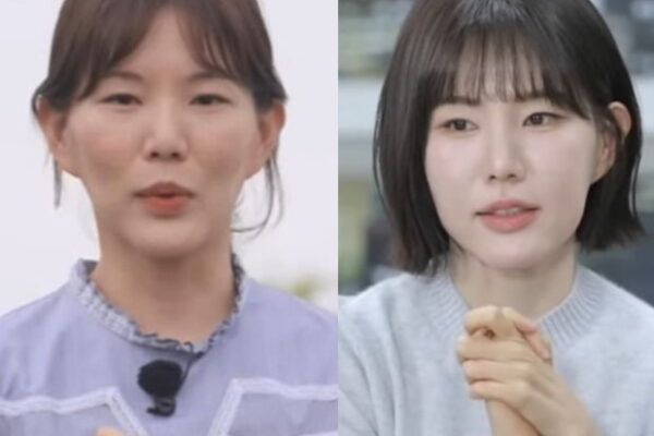 [뉴스] 보톡스·필러 맞았다 몰라보게 예뻐진 29기 현숙 비결 공개