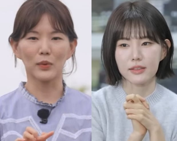 [뉴스] 보톡스·필러 맞았다 몰라보게 예뻐진 29기 현숙 비결 공개