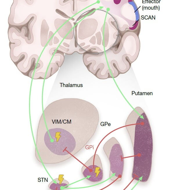 [뉴스] 파킨슨병 치료 효과 2.5배 높일 방법 찾았다…관련 시장도 주목