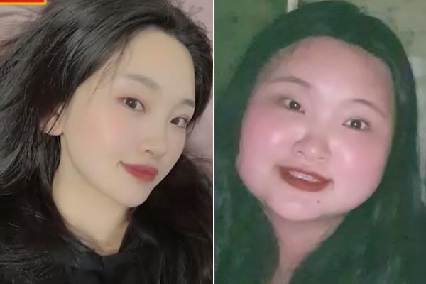 [뉴스] 119kg→59kg 기쁨도 잠시…고스란히 다시 쪘다