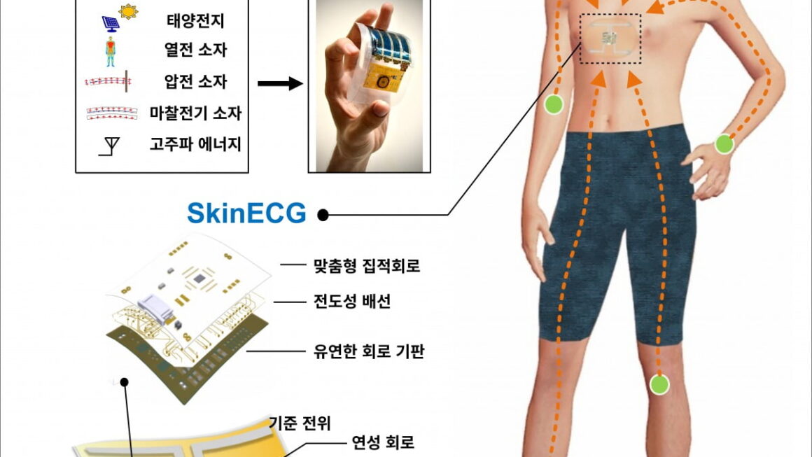 [뉴스] 팔에서 만든 전기, 무선으로 가슴까지…배터리 없는 심전도 센서 나왔다