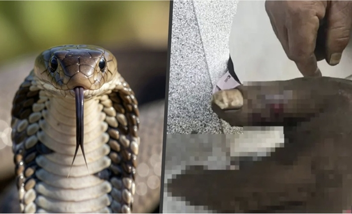 [뉴스] “독 빨아내면 산다?”…코브라에 물린 남편 구하려다 아내도 병원행